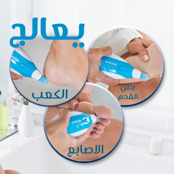⁦جهاز العناية بالقدم⁩ - الصورة ⁦2⁩