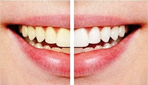 "احصل على أسنان بيضاء ومشرقة بسهولة مع قلم تبييض الأسنان Dazzling White. تعرف على كيفية الاستفادة من هذا القلم الفعّال الذي يحتوي على بيروكسيد الهيدروجين والذي يمكن أن يكون مفتاح الابتسامة الساطعة لك!" - novoloo