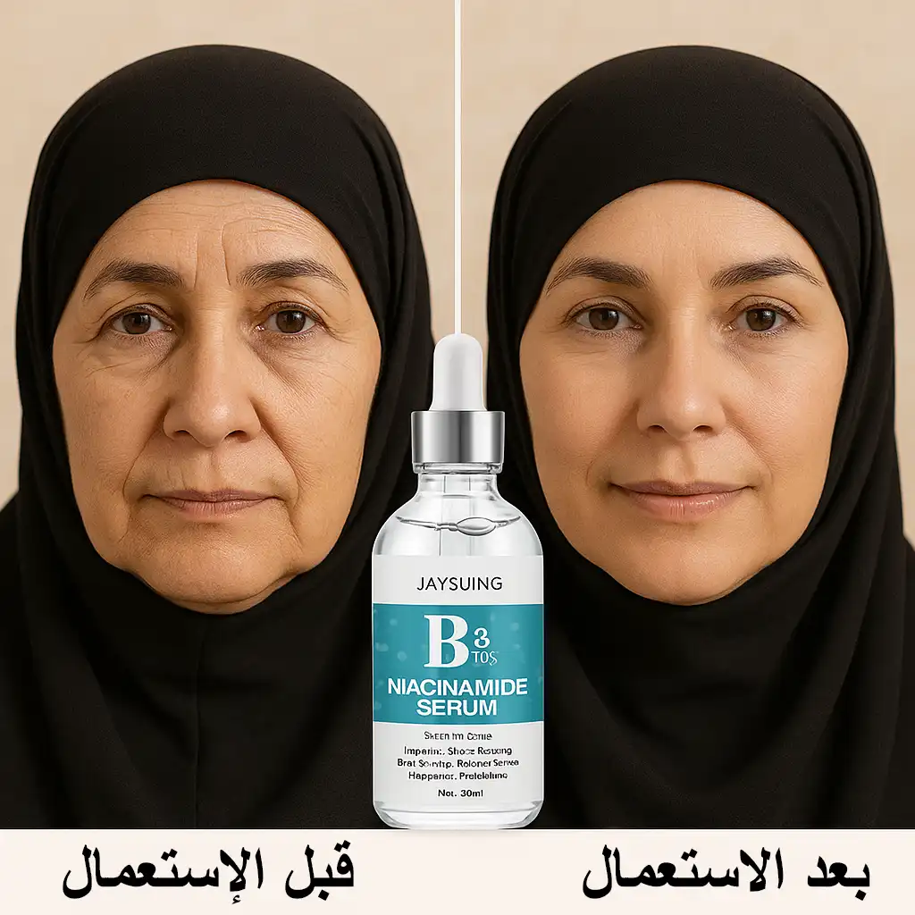 سيروم نياسيناميد للعناية بالبشرة والتفتيح ومكافحة علامات التقدم في السن، مع تقليل الانتفاخات والتجاعيد