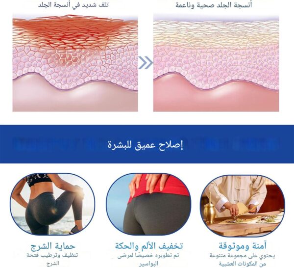 ⁦كبسولات علاج البواسير⁩ - الصورة ⁦4⁩
