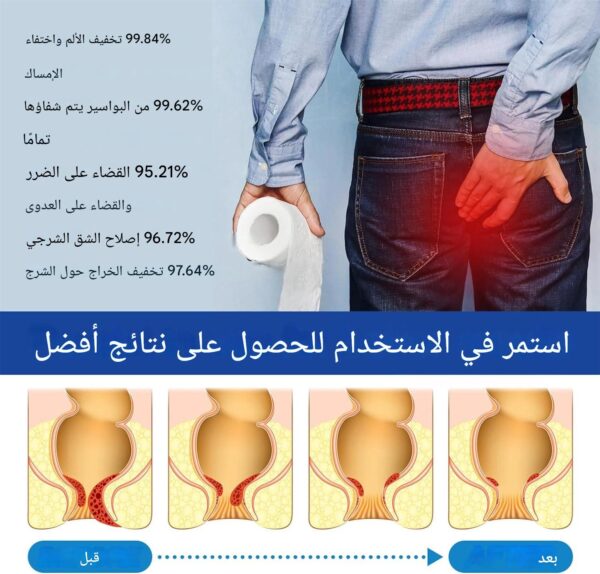 ⁦كبسولات علاج البواسير⁩ - الصورة ⁦3⁩