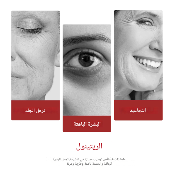 ⁦كريم الريتينول لإزالة التجاعيد ومكافحة علامات التقدم في السن⁩ - الصورة ⁦6⁩